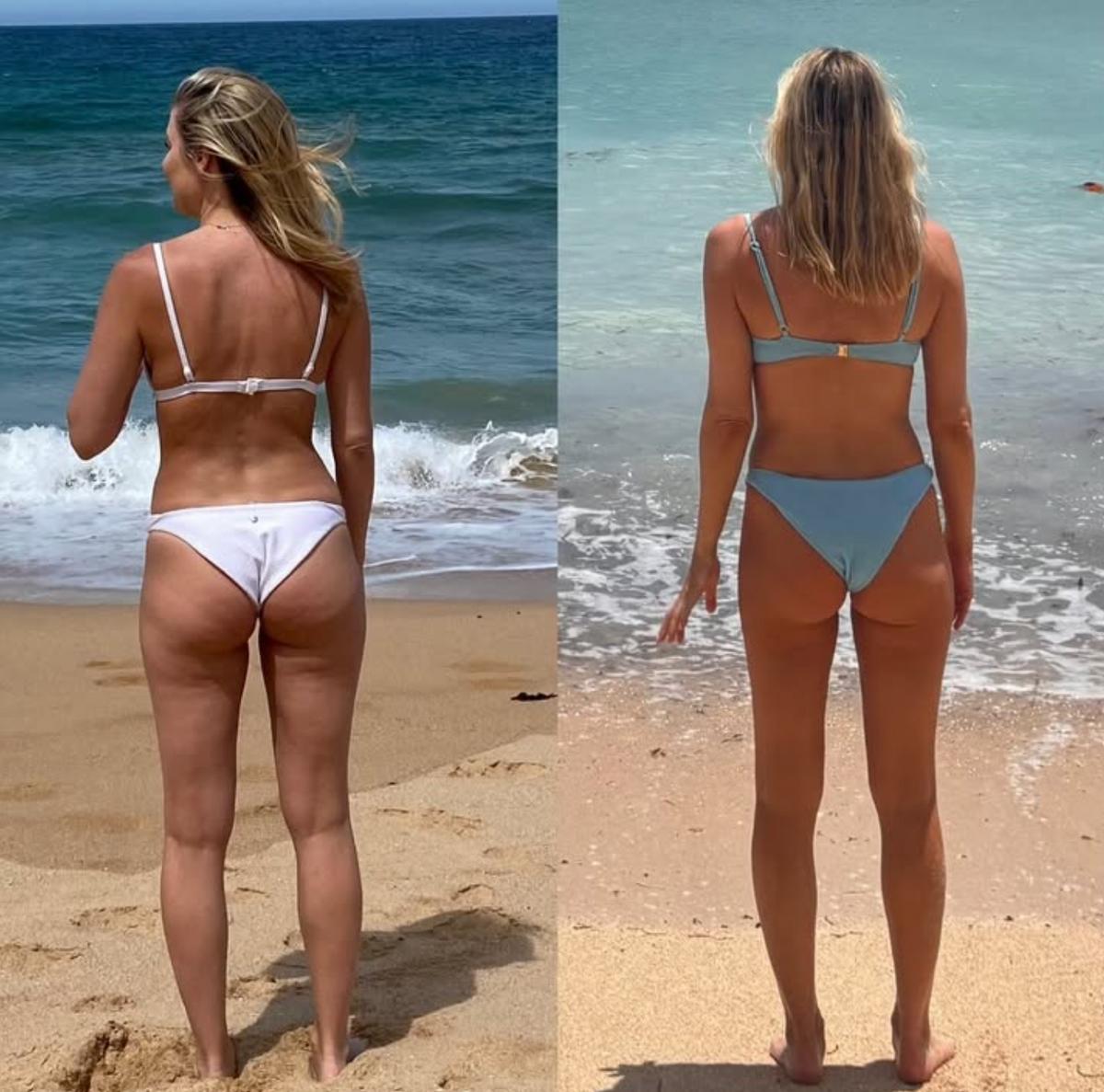 Side by side comparison showing results of a women's gut health supplement